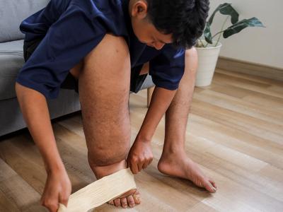 Lymphedema Care at Home: Tips from Certified Fitters